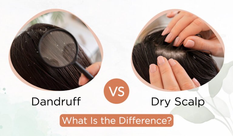 Dandruff Vs Dry Scalp: What Is The Difference? - The Indie Earth